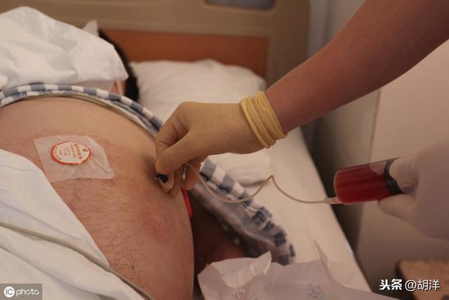 不小心把癌症腹水滴在手上有什么后果<strong></p>
<p>币安数字货币</strong>?