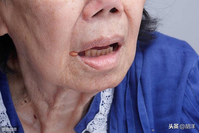 口腔溃疡预示哪些病<strong></p>
<p>币安app最新版</strong>?